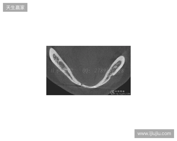 韦林顿确诊上唇部贯通伤；11、21牙半脱位；上颌前牙区牙槽骨骨折
